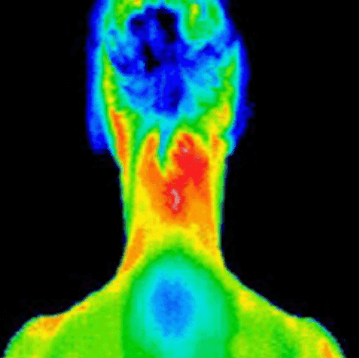 FMSTherm