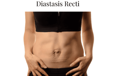 Diastasis Recti – What the heck is that?
